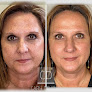 Lemmon Avenue Plastic Surgery and Laser Center